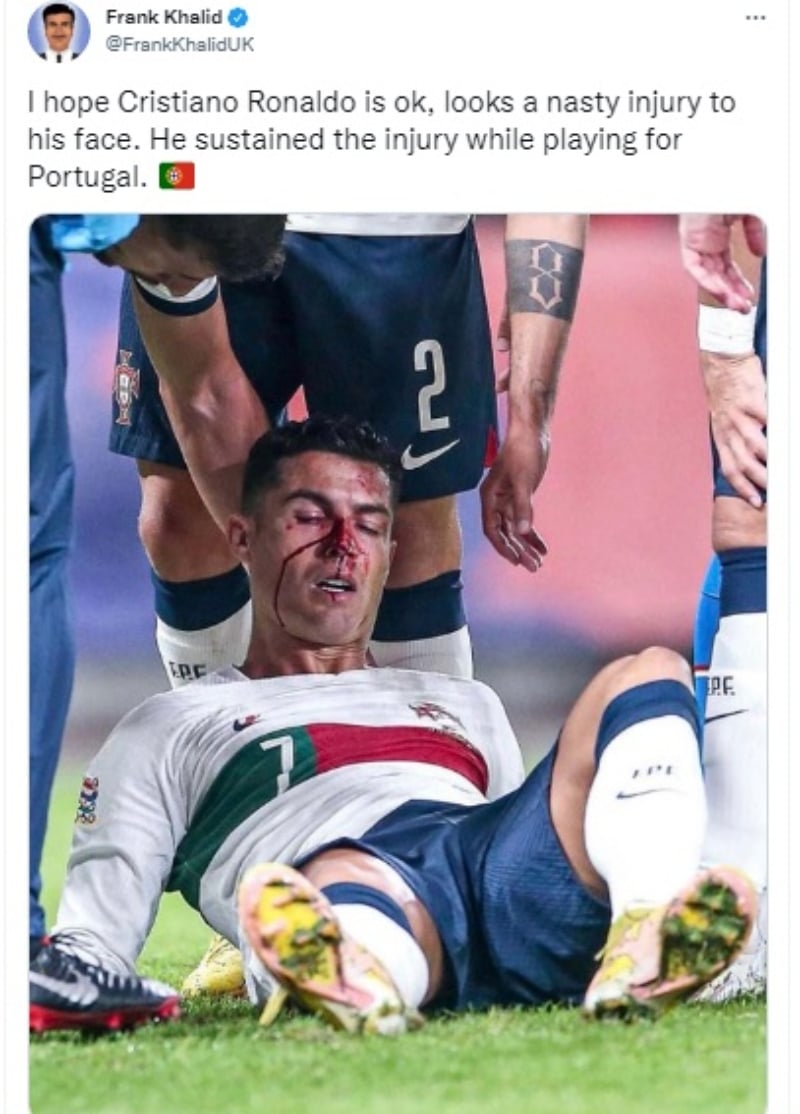 Cristiano Ronaldo choque nariz: Sufre una hemorragia