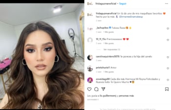 ¿La comparan con Emily Álvarez?