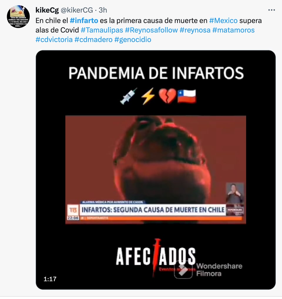 Síntomas del infarto agudo de miocardio