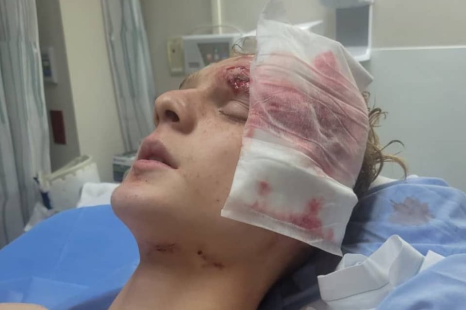 justicia, accidente, vehículo, policía, latina