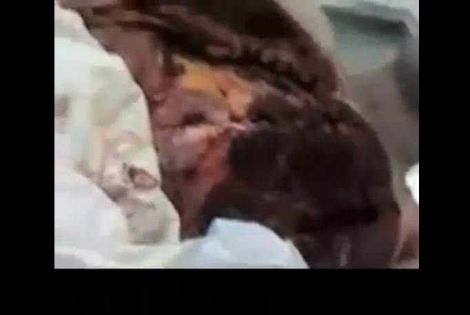 The body of Valentin's corpse completely opened