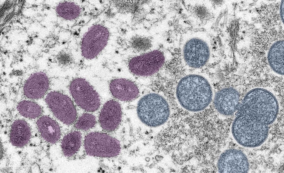 Norovirus
