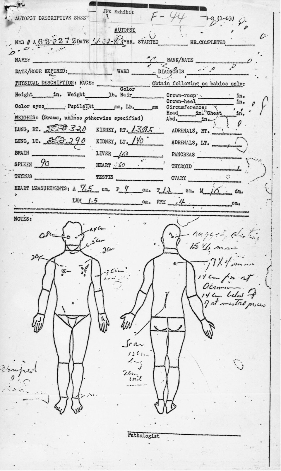 John F. Kennedy autopsy photos