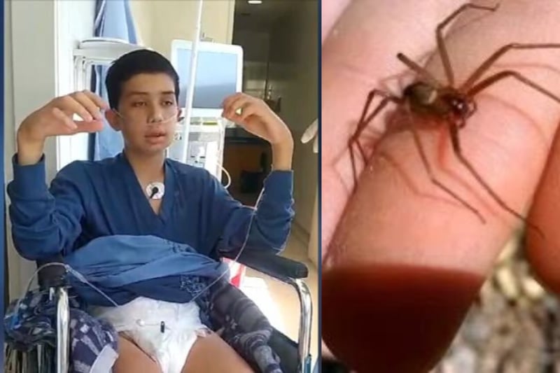Boy Nearly Dies from Spider Bite, MundoNow, Joshua Fager,