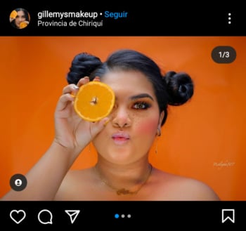 La vitamina C