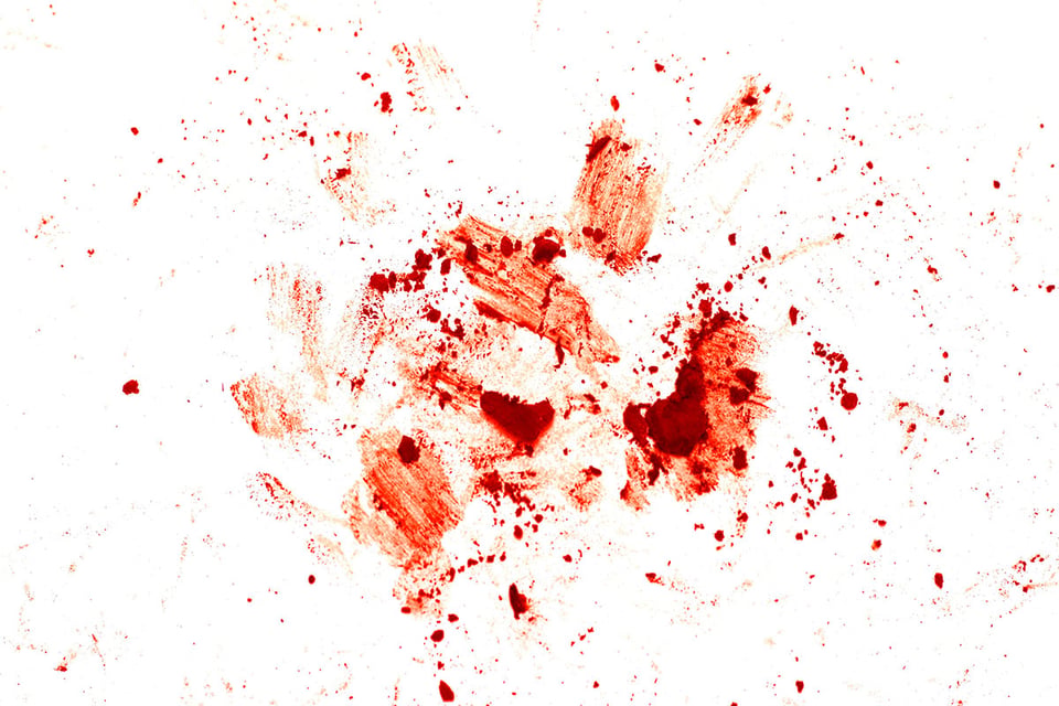 Sangre, Herida, Rojo, MundoNow, Podcast