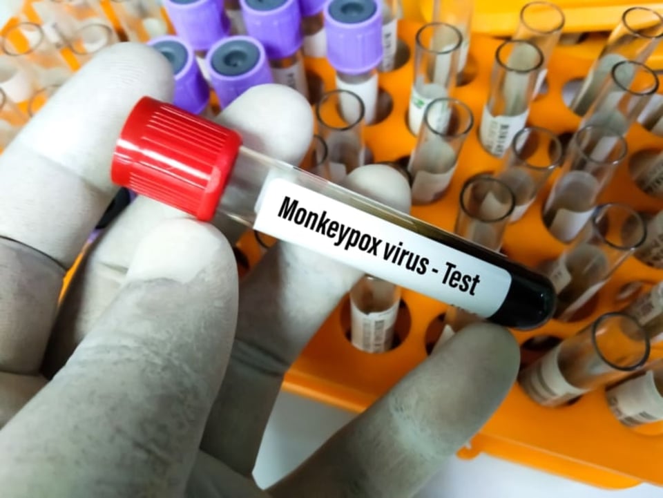 Virus mortal