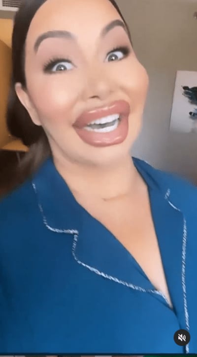 Chiquis wanted to 'be funny' with her exaggerated and disfigured mouth and they tell her that she actually has it