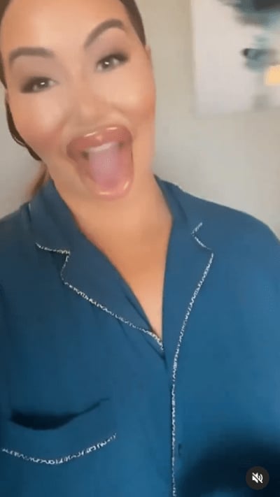 Chiquis Rivera appears with large and misshapen lips