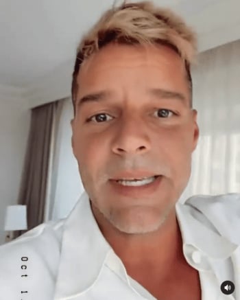 "Now explain it without filter"; Ricky Martin comes out to show his face after rumors of operation