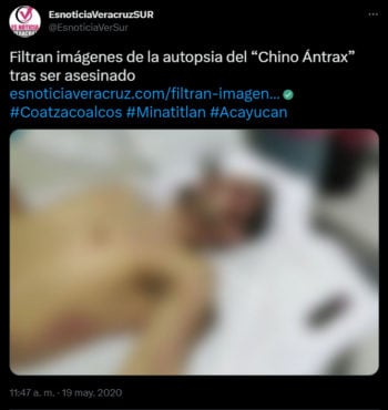 La autopsia del Chino Ántrax