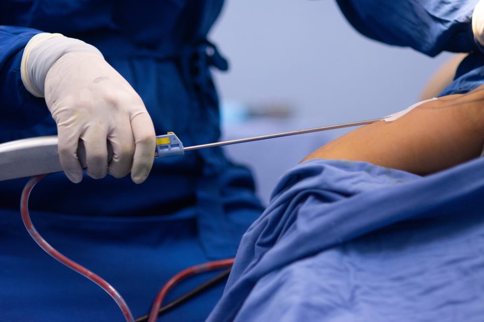 Nurse dies liposuction: It was breach of trust