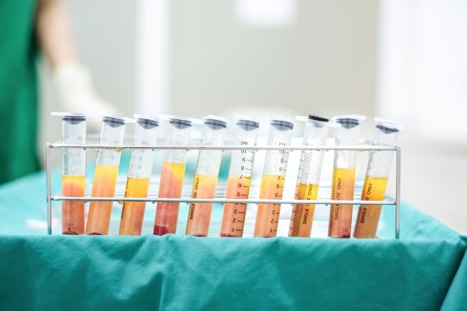 Nurse dies liposuction: They tried to revive her