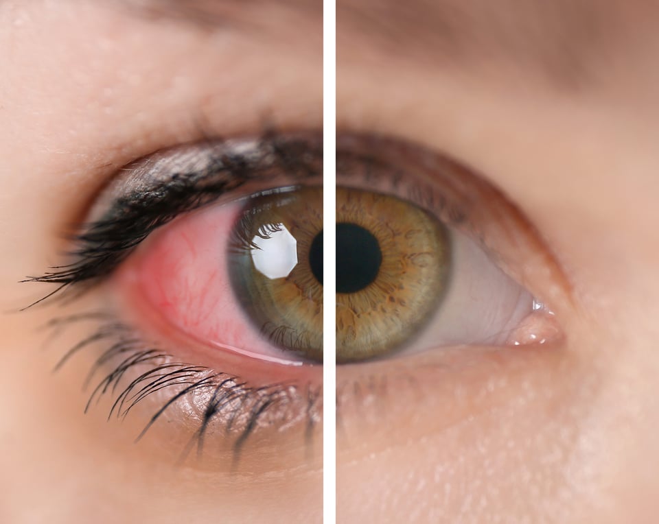 rare autoimmune diseases