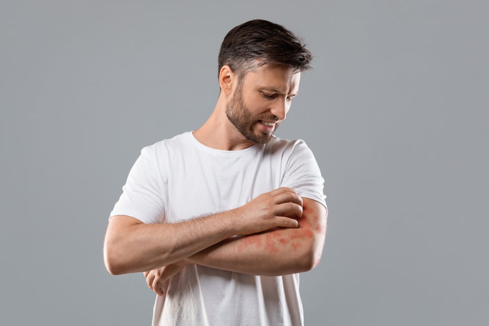 Psoriasis Psoriasis