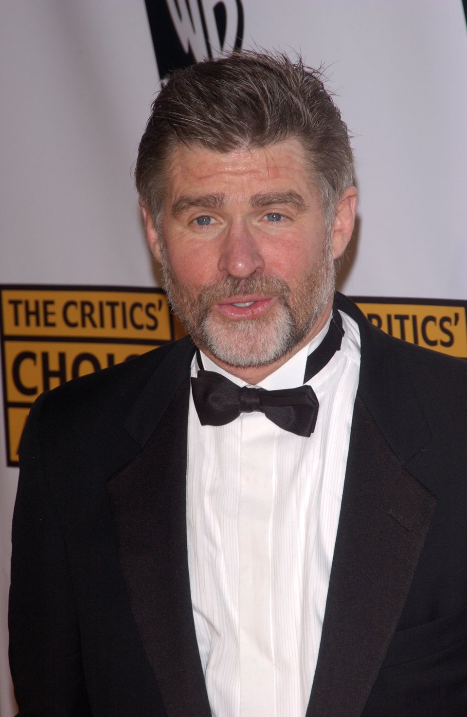 Star suffers terrible accident