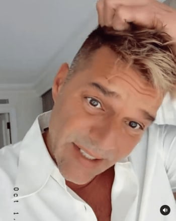 "It was an allergic reaction"; Ricky Martin comes out to show his face after rumors of operation