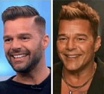 Was Ricky Martin's face deformed?